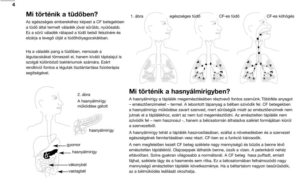 ábra egészséges tüdő CF-es tüdő CF-es köhögés Ha a váladék pang a tüdőben, nemcsak a légutacskákat tömeszeli el, hanem kíváló táptalajul is szolgál különböző baktériumok számára.