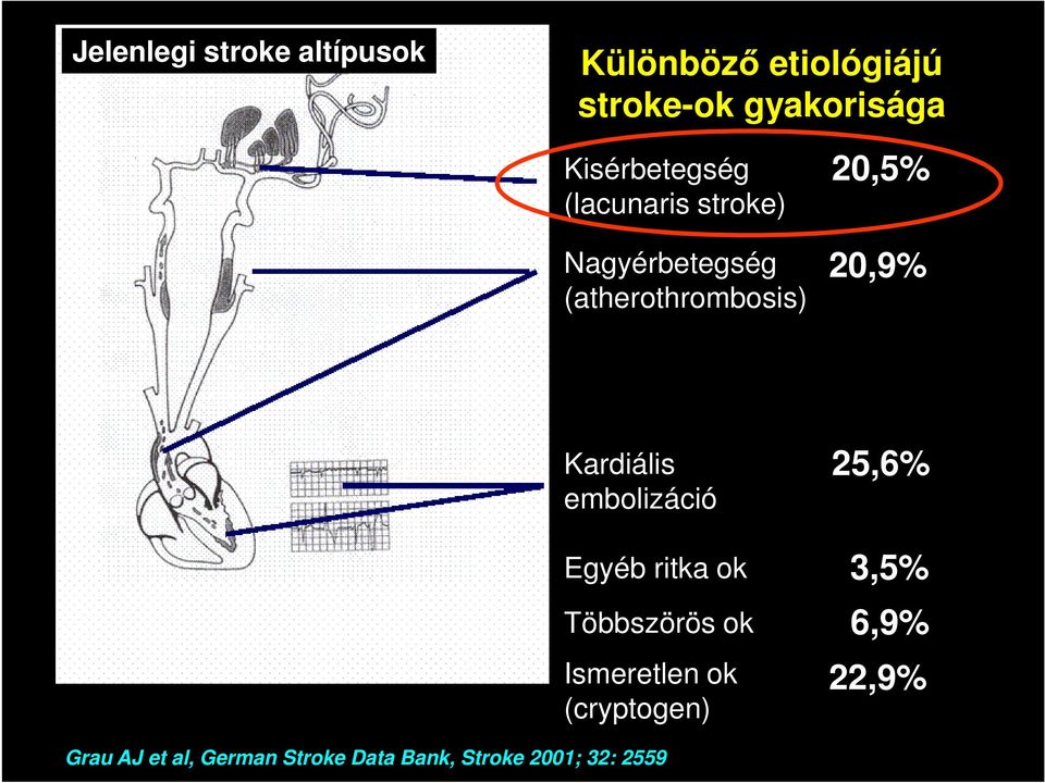 20,9% Kardiális embolizáció Egyéb ritka ok Többszörös ok Ismeretlen ok