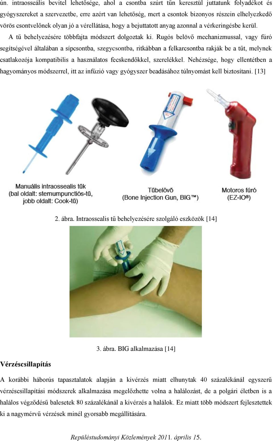 Rugós belövő mechanizmussal, vagy fúró segítségével általában a sípcsontba, szegycsontba, ritkábban a felkarcsontba rakják be a tűt, melynek csatlakozója kompatibilis a használatos fecskendőkkel,