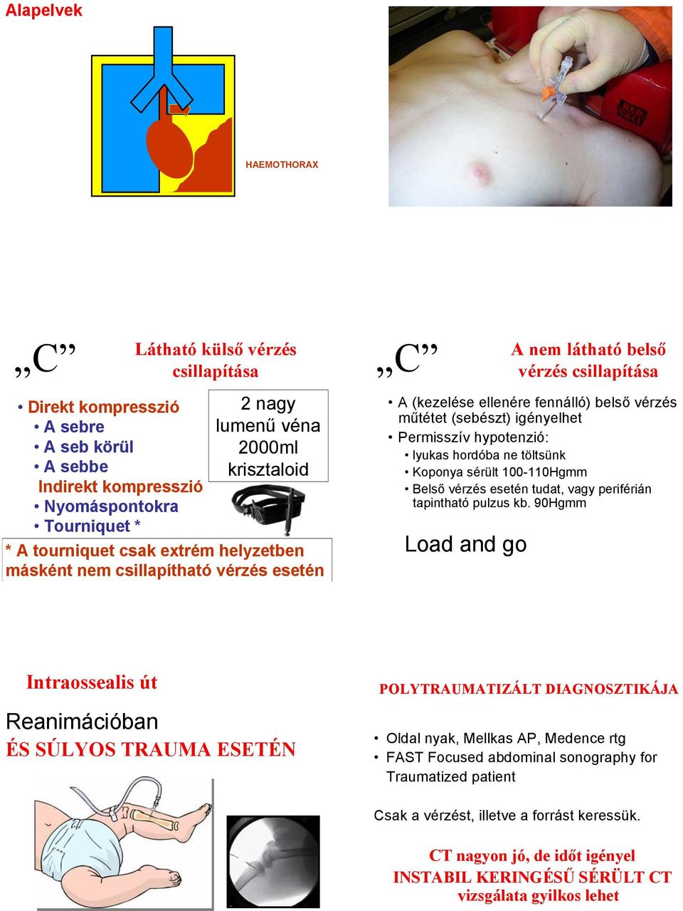 hypotenzió: lyukas hordóba ne töltsünk Koponya sérült 100-110Hgmm Belső vérzés esetén tudat, vagy periférián tapintható pulzus kb.