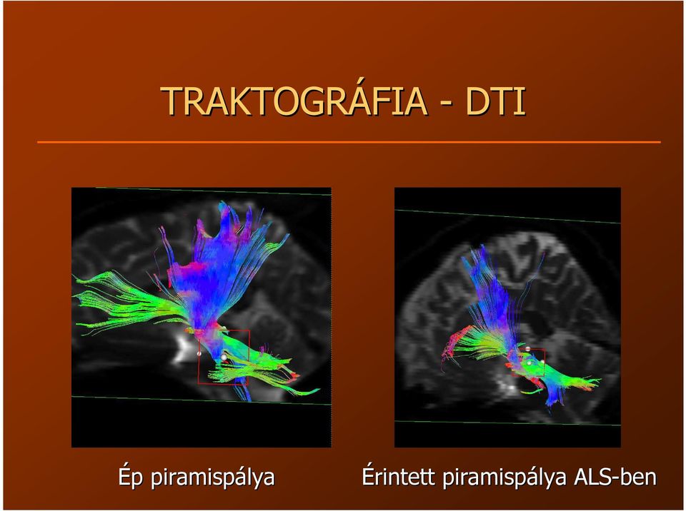 piramispálya