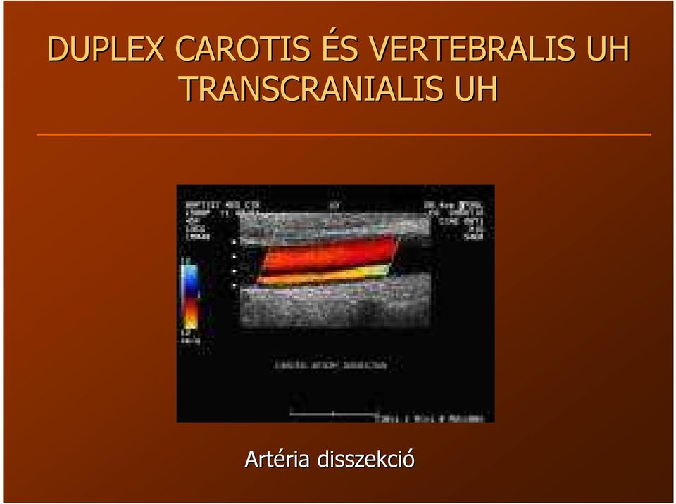 TRANSCRANIALIS UH