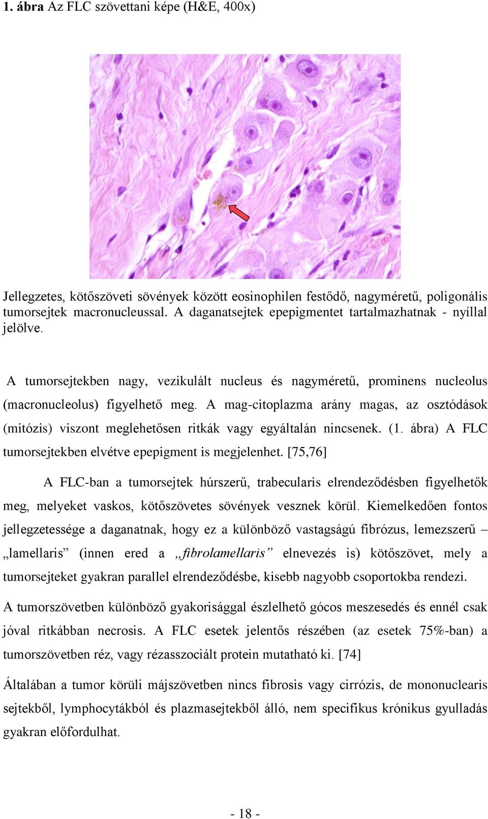 A mag-citoplazma arány magas, az osztódások (mitózis) viszont meglehetősen ritkák vagy egyáltalán nincsenek. (1. ábra) A FLC tumorsejtekben elvétve epepigment is megjelenhet.