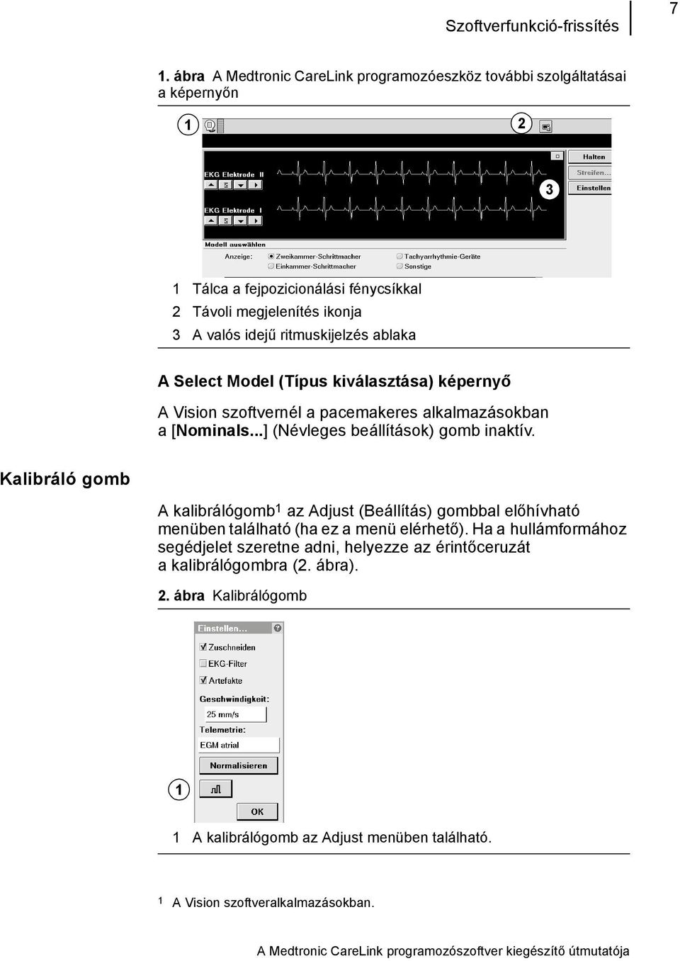ablaka A Select Model (Típus kiválasztása) képernyő A Vision szoftvernél a pacemakeres alkalmazásokban a[nominals...] (Névleges beállítások) gomb inaktív.