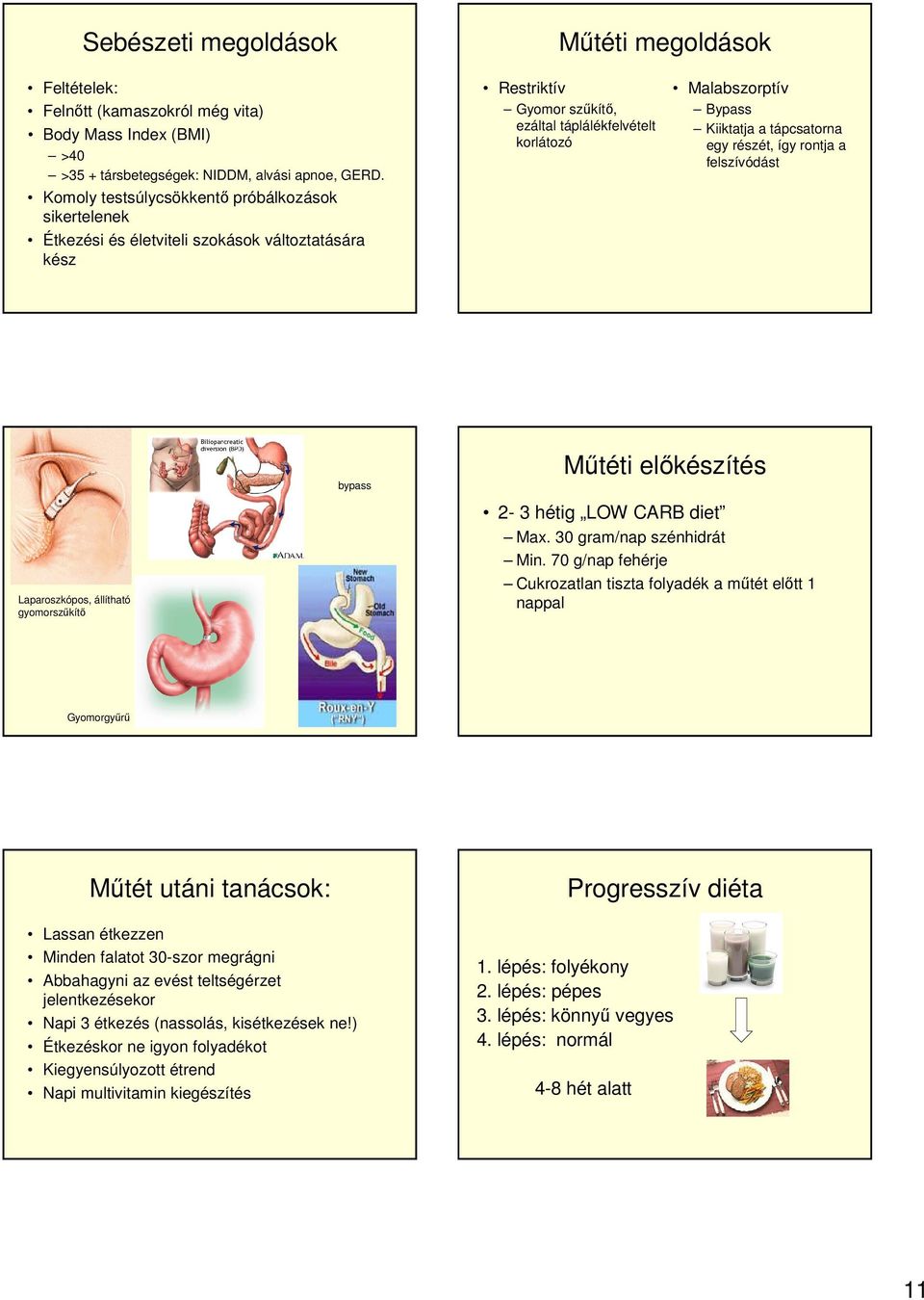 tápcsatorna egy részét, így rontja a felszívódást Laparoszkópos, állítható gyomorszűkítő bypass Műtéti előkészítés 2-3 hétig LOW CARB diet Max. 30 gram/nap szénhidrát Min.