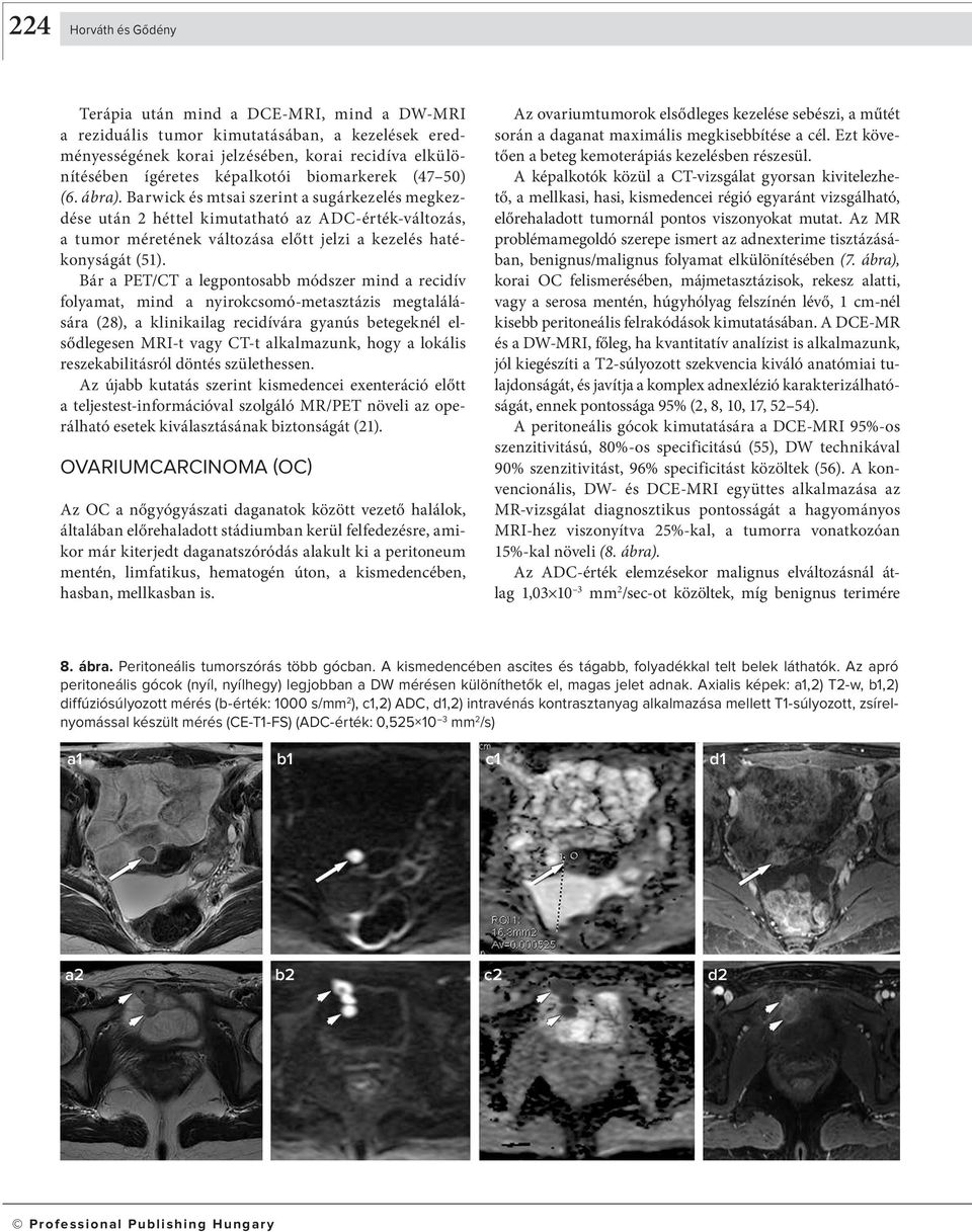 Bár a PET/CT a legpontosa módszer mind a recidív folyamat, mind a nyirokcsomó-metasztázis megtalálására (28), a klinikailag recidívára gyanús etegeknél elsődlegesen MRI-t vagy CT-t alkalmazunk, hogy