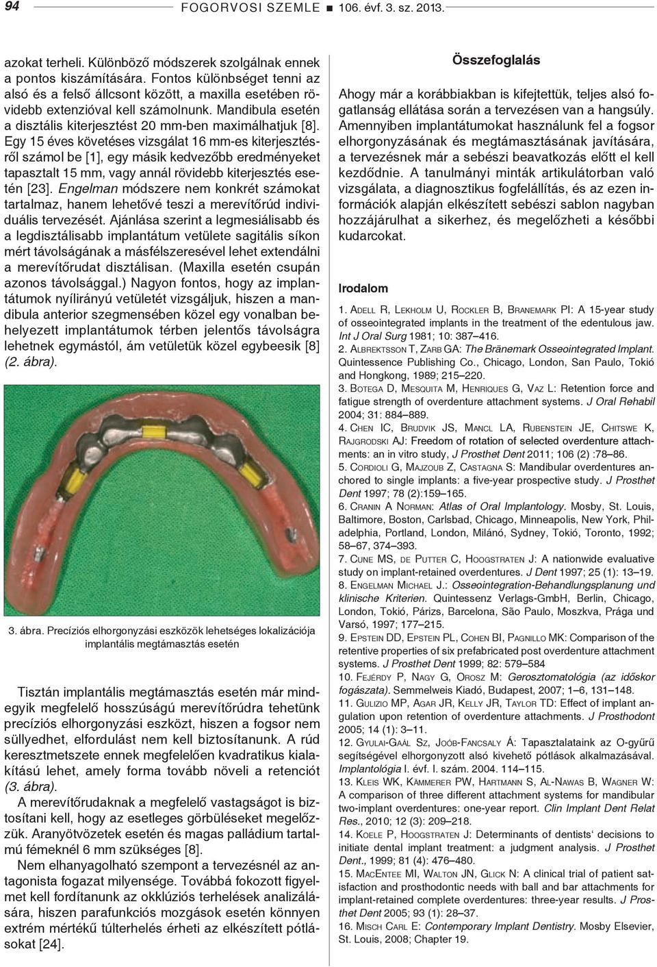 Egy 15 éves követéses vizsgálat 16 mm-es kiterjesztésről számol be [1], egy másik kedvezőbb eredmé nyeket tapasztalt 15 mm, vagy annál rövidebb kiterjesztés esetén [23].