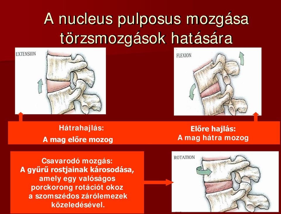 mozog Csavarodó mozgás: A gyűrű rostjainak károsodása, amely