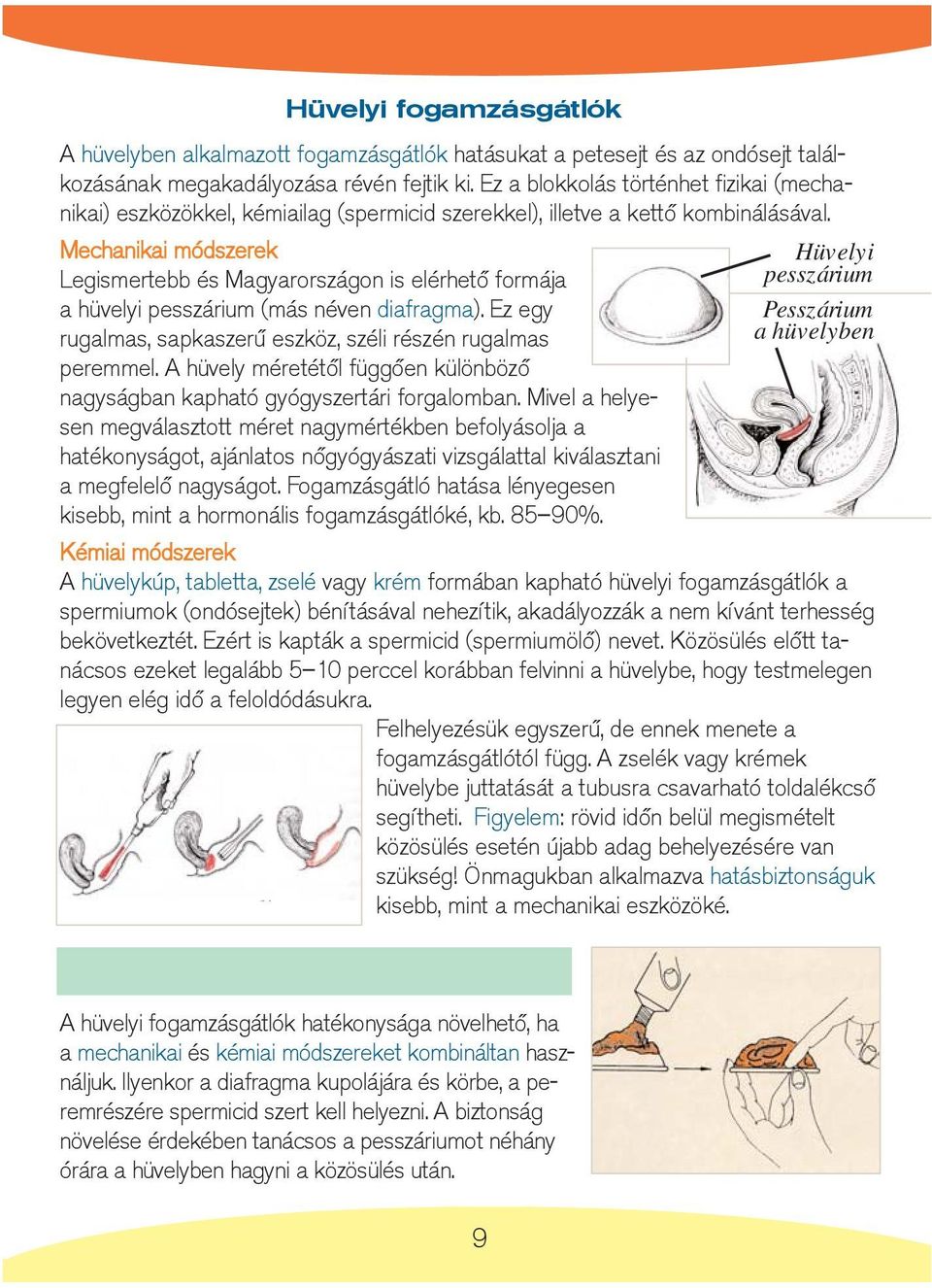 Mechanikai módszerek Legismertebb és Magyarországon is elérhetõ formája a hüvelyi pesszárium (más néven diafragma). Ez egy rugalmas, sapkaszerû eszköz, széli részén rugalmas peremmel.