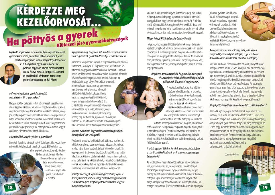 egymás után az összes gyereket napjában ötször, mert viszkettek azok a fránya himlők. Pöttyökről, okokról és kezelésekről kérdeztem homeopata gyermekorvosunkat, dr. Sal Pétert.