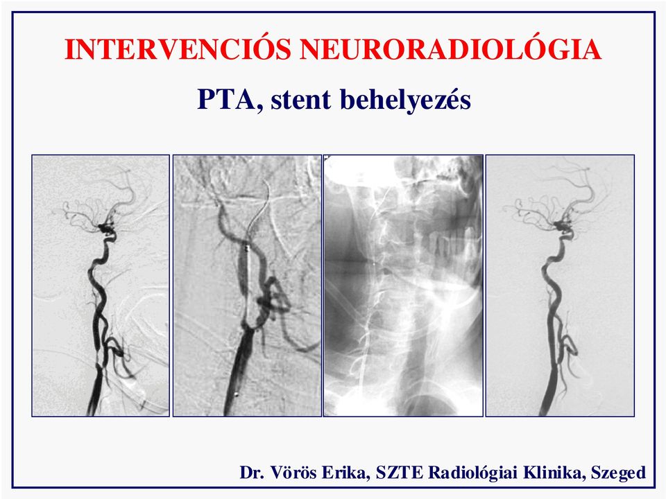 stent behelyezés Dr.