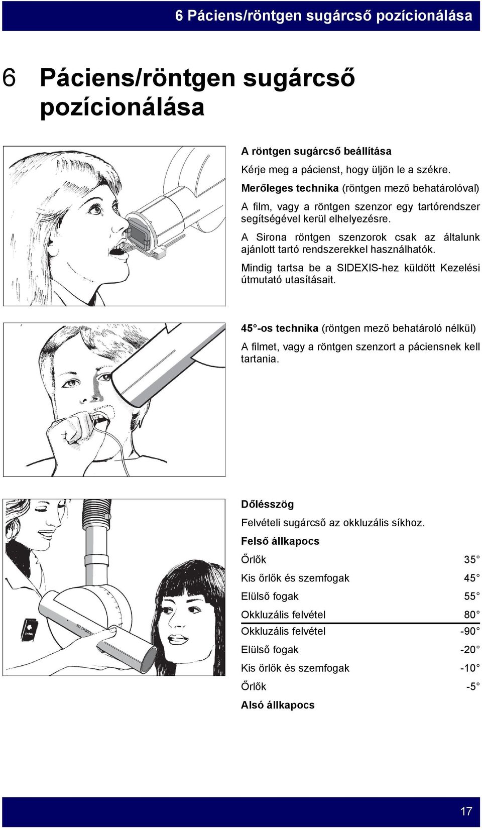 A Sirona röntgen szenzorok csak az általunk ajánlott tartó rendszerekkel használhatók. Mindig tartsa be a SIDEXIS-hez küldött Kezelési útmutató utasításait.