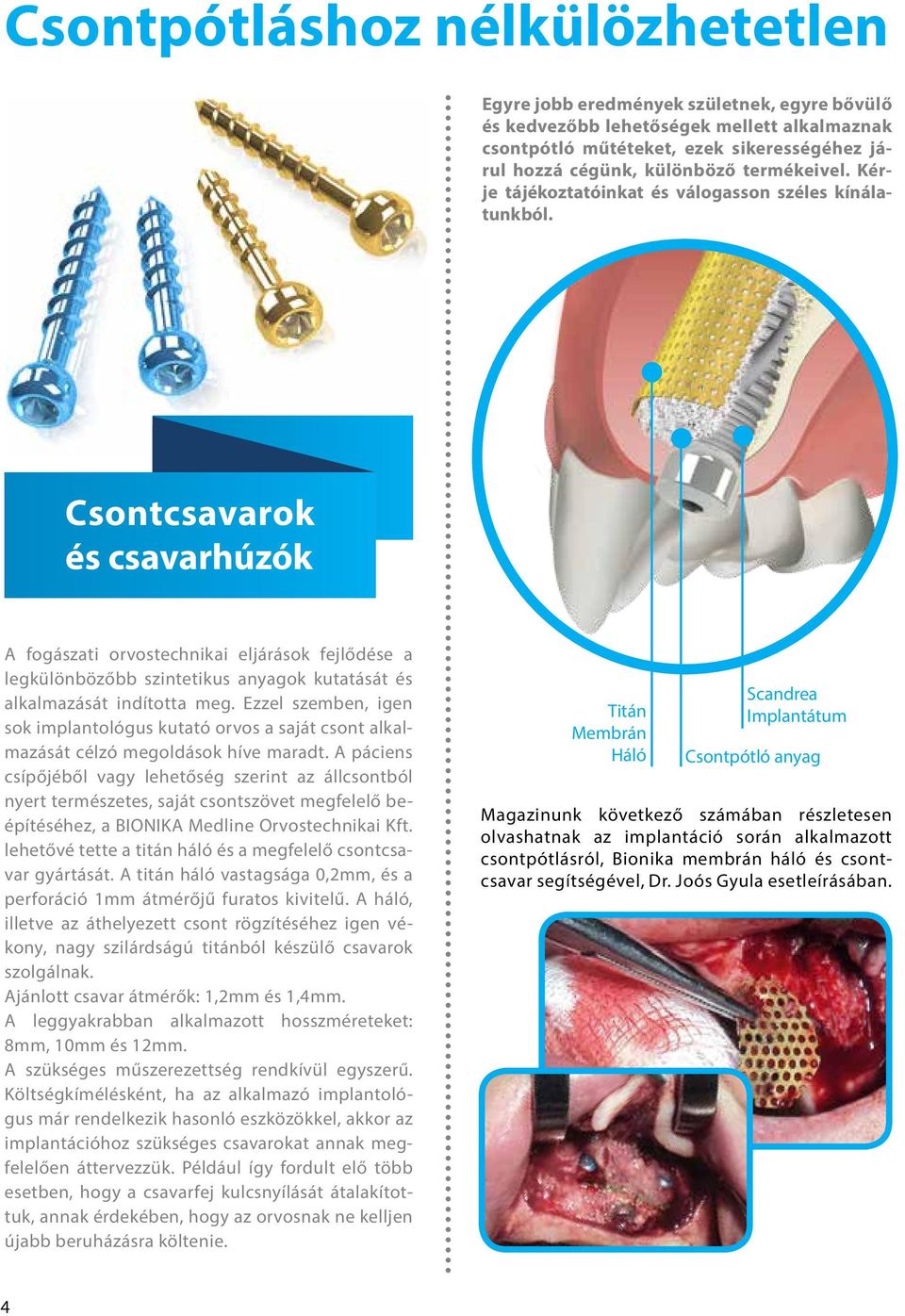 Csontcsavarok és csavarhúzók A fogászati orvostechnikai eljárások fejlődése a legkülönbözőbb szintetikus anyagok kutatását és alkalmazását indította meg.