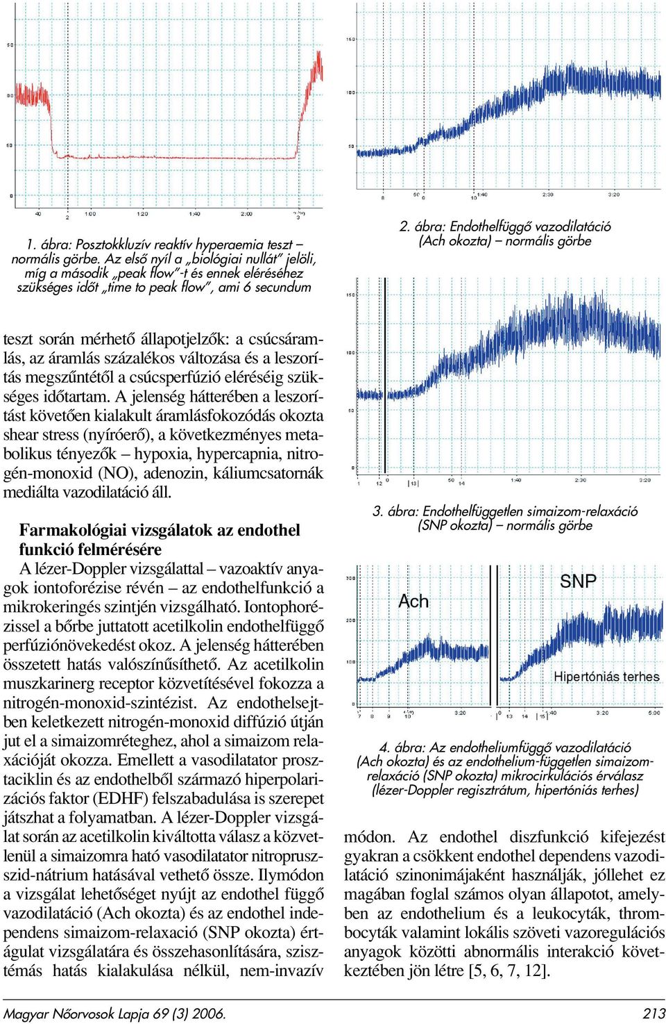 ábra: Endothelfüggô vazodilatáció (Ach okozta) normális görbe teszt során mérhetô állapotjelzôk: a csúcsáramlás, az áramlás százalékos változása és a leszorítás megszûntétôl a csúcsperfúzió eléréséig