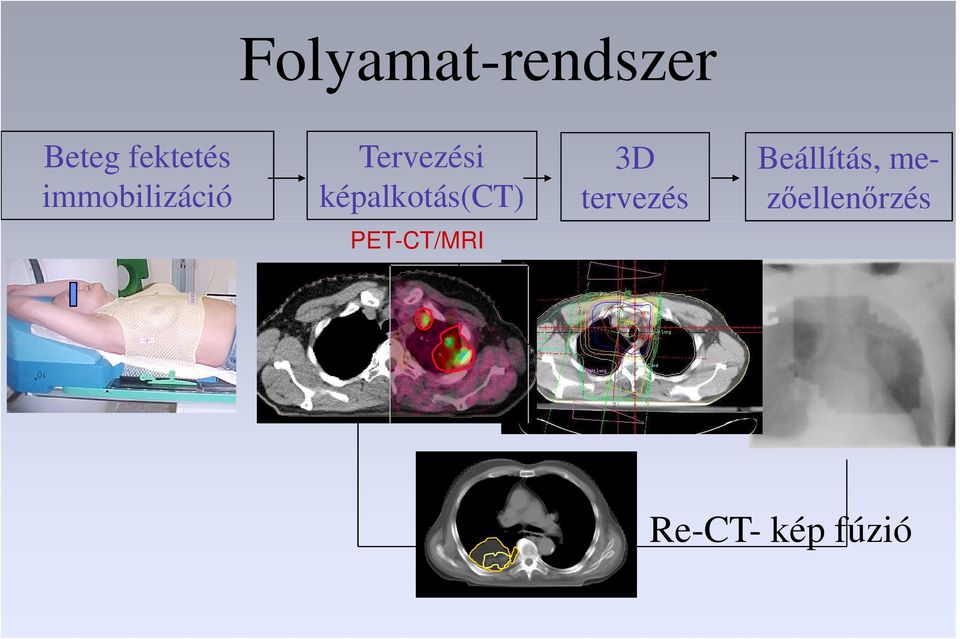 képalkotás(ct) 3D tervezés