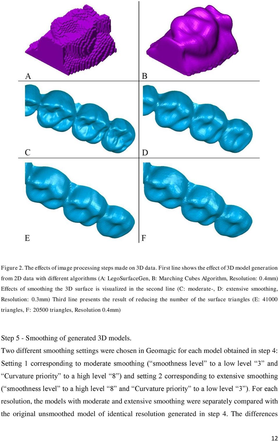 4mm) Effects of smoothing the 3D surface is visualized in the second line (C: moderate-, D: extensive smoothing, Resolution: 0.