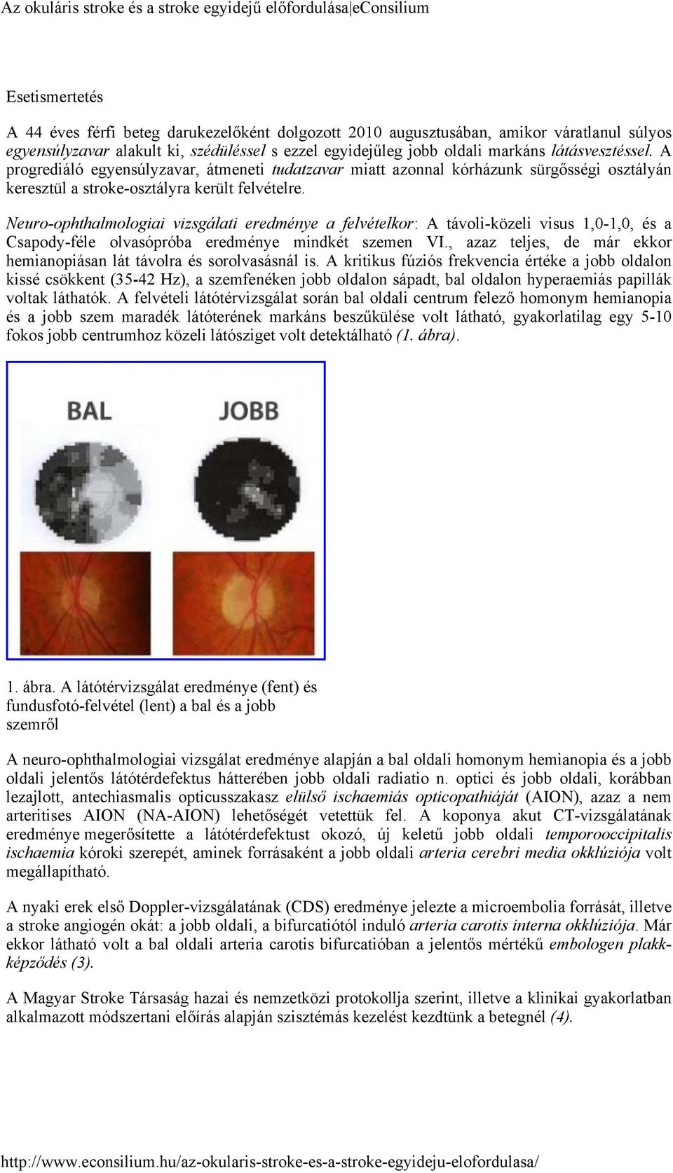 Neuro-ophthalmologiai vizsgálati eredménye a felvételkor: A távoli-közeli visus 1,0-1,0, és a Csapody-féle olvasópróba eredménye mindkét szemen VI.