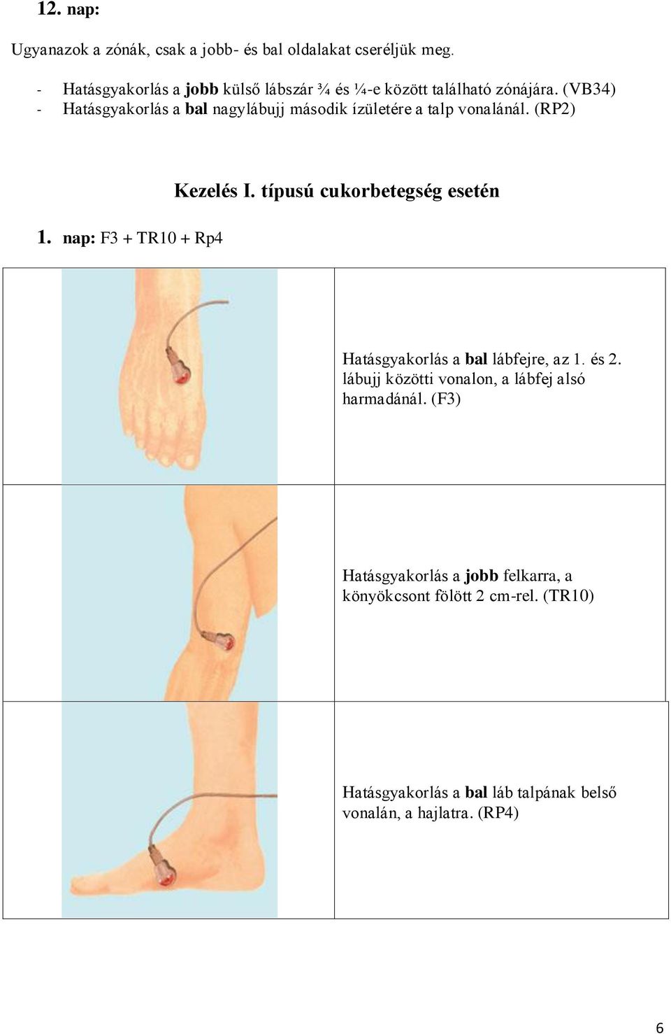 (VB34) - Hatásgyakorlás a bal nagylábujj második ízületére a talp vonalánál. (RP2) 1. nap: F3 + TR10 + Rp4 Kezelés I.