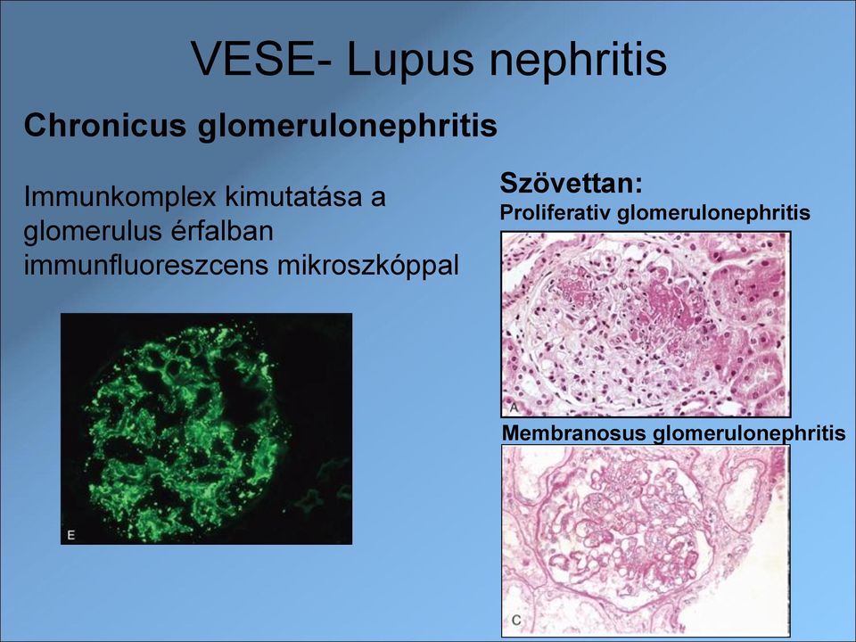 immunfluoreszcens mikroszkóppal Szövettan: