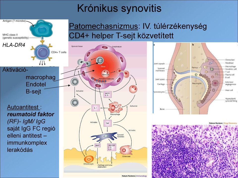 Aktivációmacrophag Endotel B-sejt Autoantitest : reumatoid