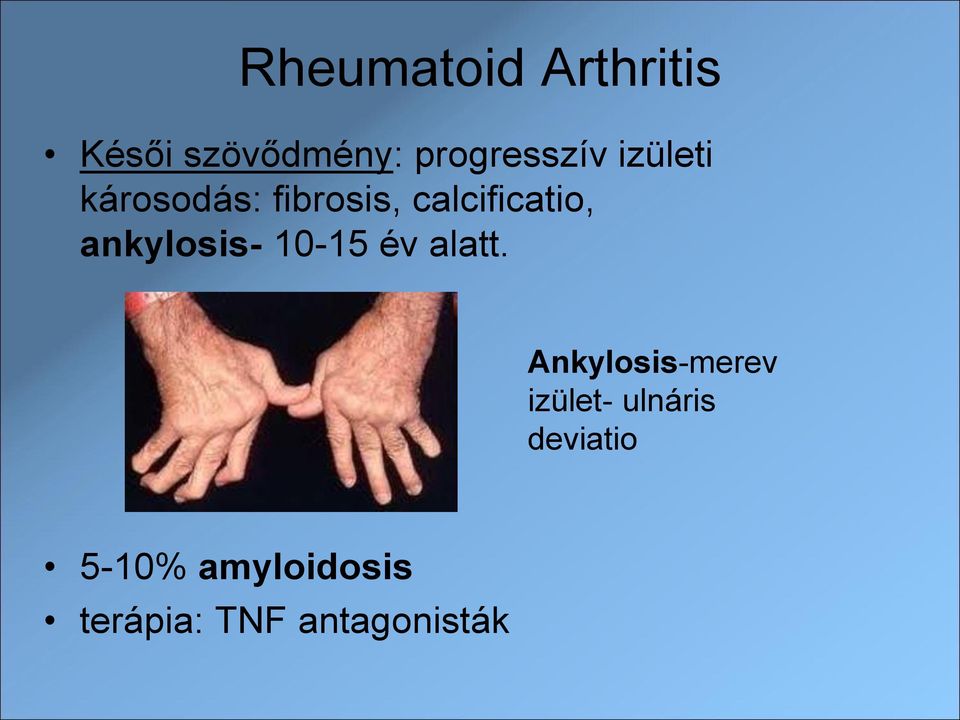 ankylosis- 10-15 év alatt.