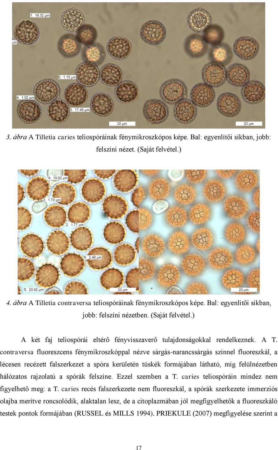 contraversa fluoreszcens fénymikroszkóppal nézve sárgás-narancssárgás színnel fluoreszkál, a lécesen recézett falszerkezet a spóra kerületén tüskék formájában látható, míg felülnézetben hálózatos