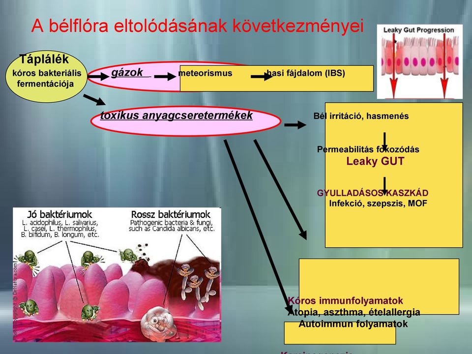 hasmenés Permeabilitás fokozódás Leaky GUT GYULLADÁSOS KASZKÁD Infekció,