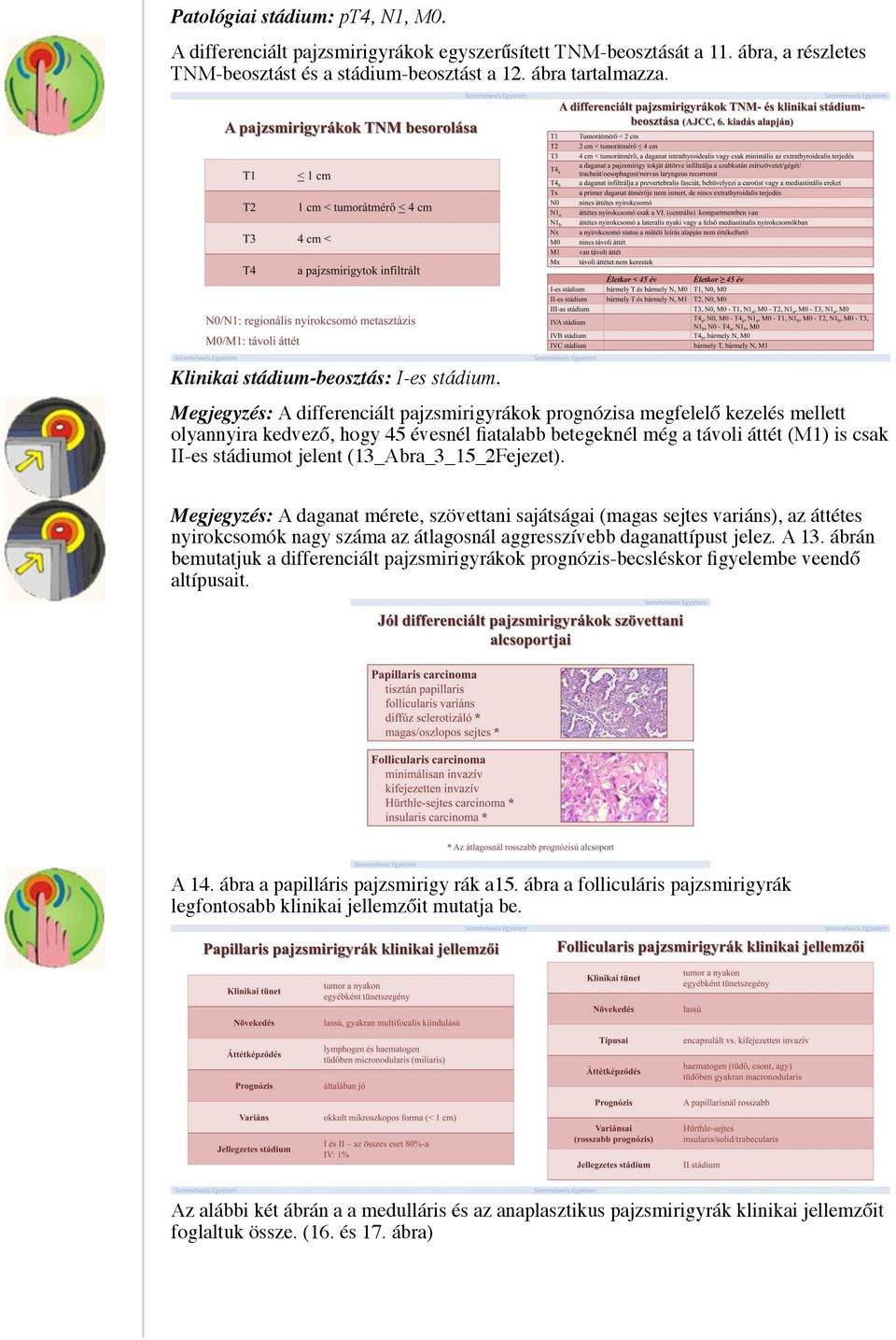 Megjegyzés: A differenciált pajzsmirigyrákok prognózisa megfelelő kezelés mellett olyannyira kedvező, hogy 45 évesnél fiatalabb betegeknél még a távoli áttét (M1) is csak II-es stádiumot jelent