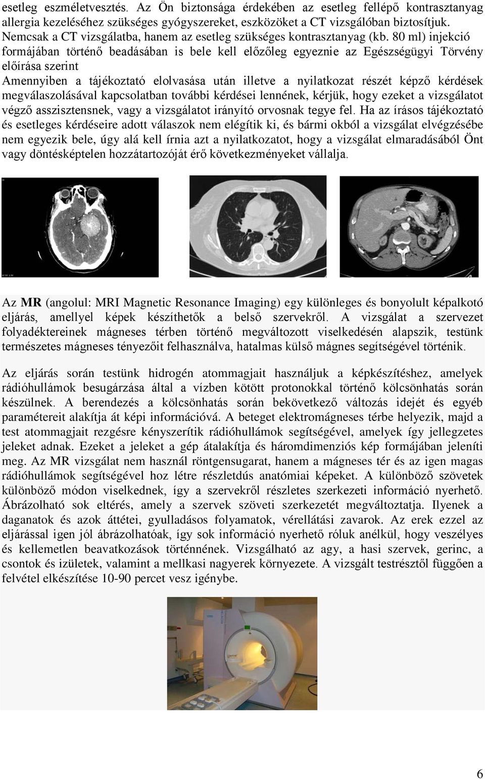 80 ml) injekció formájában történő beadásában is bele kell előzőleg egyeznie az Egészségügyi Törvény előírása szerint Amennyiben a tájékoztató elolvasása után illetve a nyilatkozat részét képző