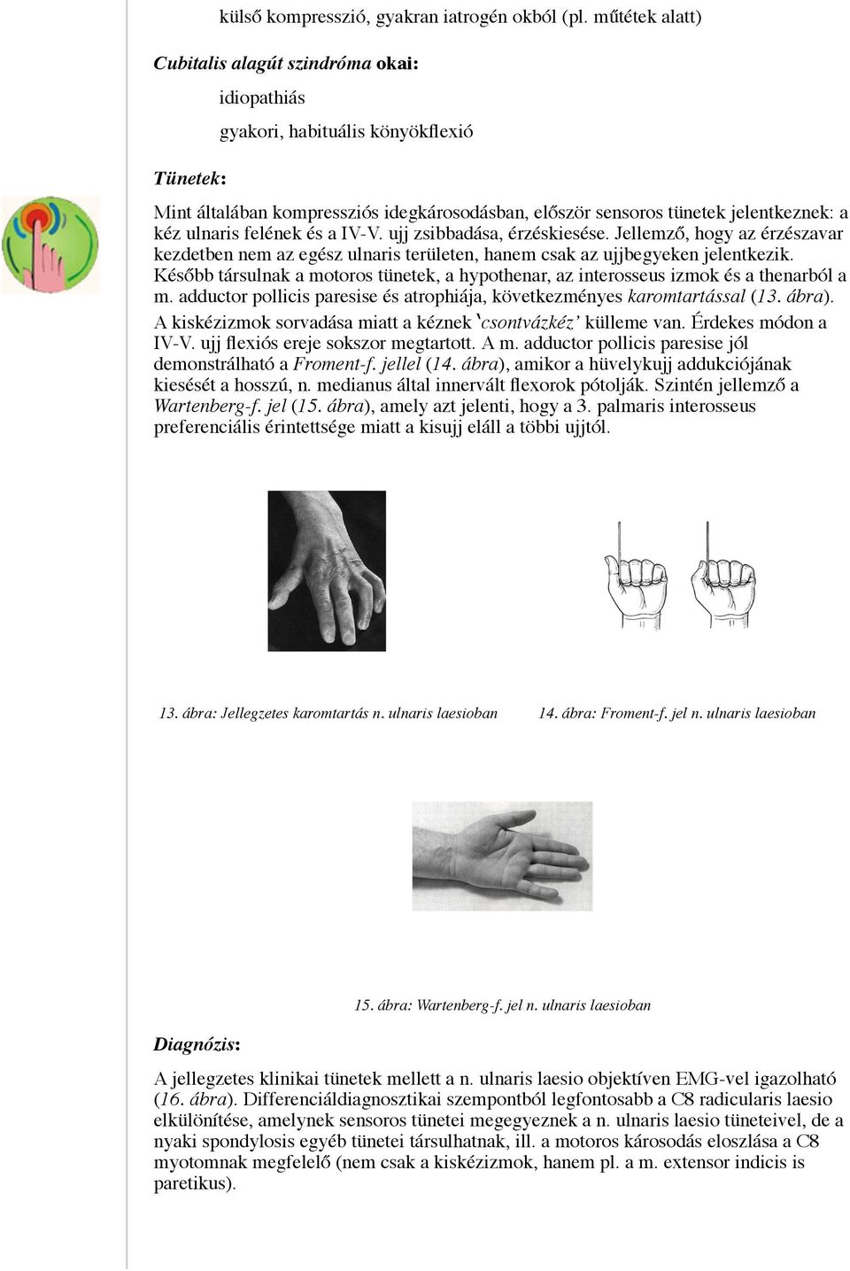 ulnaris felének és a IV-V. ujj zsibbadása, érzéskiesése. Jellemző, hogy az érzészavar kezdetben nem az egész ulnaris területen, hanem csak az ujjbegyeken jelentkezik.