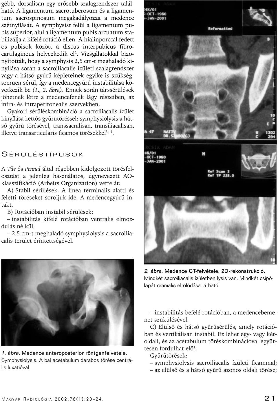 A hialinporccal fedett os pubisok között a discus interpubicus fibrocartilagineus helyezkedik el 2.