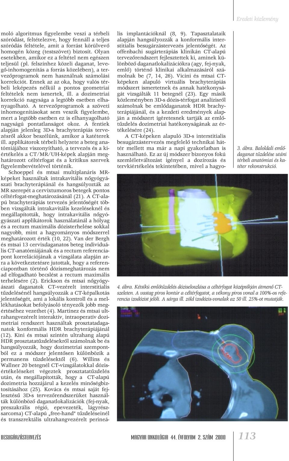 Ennek az az oka, hogy valós térbeli leképezés nélkül a pontos geometriai feltételek nem ismertek, ill. a dozimetriai korrekció nagysága a legtöbb esetben elhanyagolható.