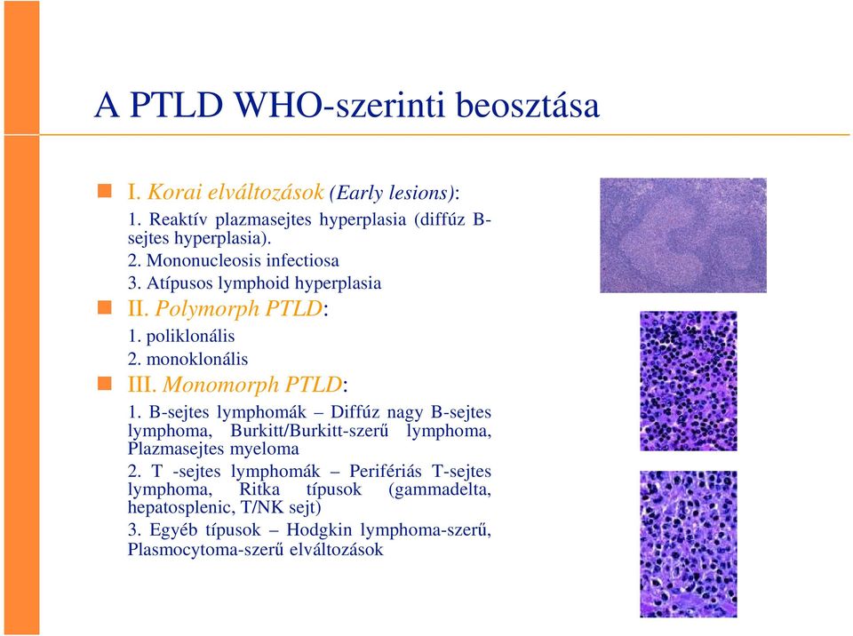 B-sejtes lymphomák Diffúz nagy B-sejtes lymphoma, Burkitt/Burkitt-szerű lymphoma, Plazmasejtes myeloma 2.