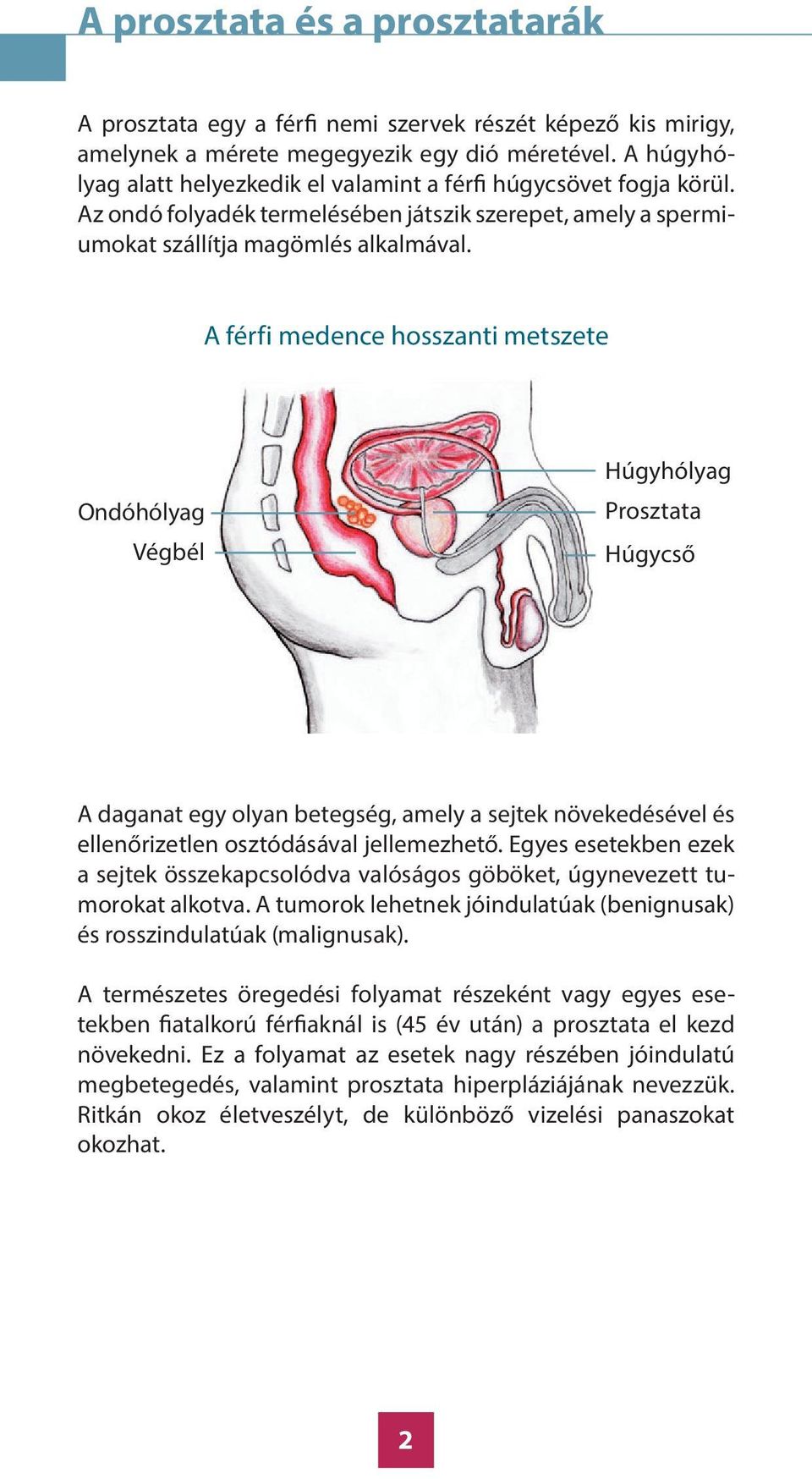 A férfi medence hosszanti metszete Ondóhólyag Végbél Húgyhólyag Prosztata Húgycső A daganat egy olyan betegség, amely a sejtek növekedésével és ellenőrizetlen osztódásával jellemezhető.