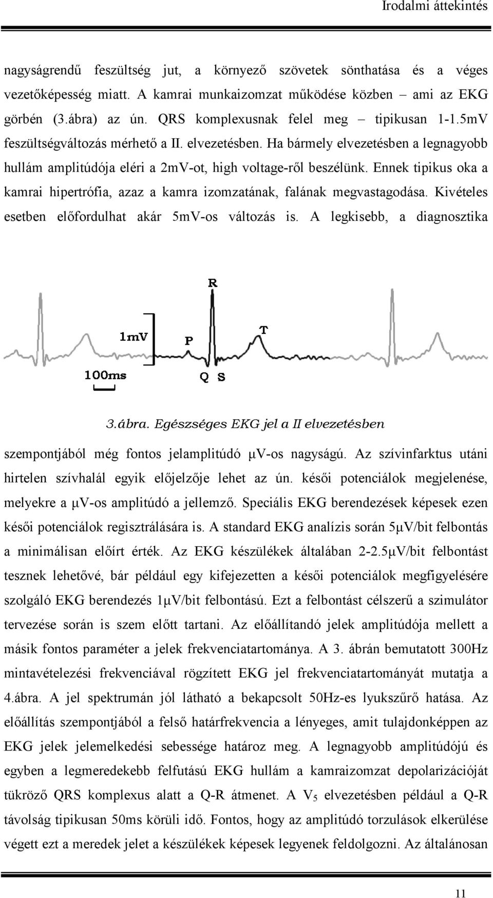 Ennek tipikus oka a kamrai hipertrófia, azaz a kamra izomzatának, falának megvastagodása. Kivételes esetben el(fordulhat akár 5mV-os változás is. A legkisebb, a diagnosztika 3.ábra.