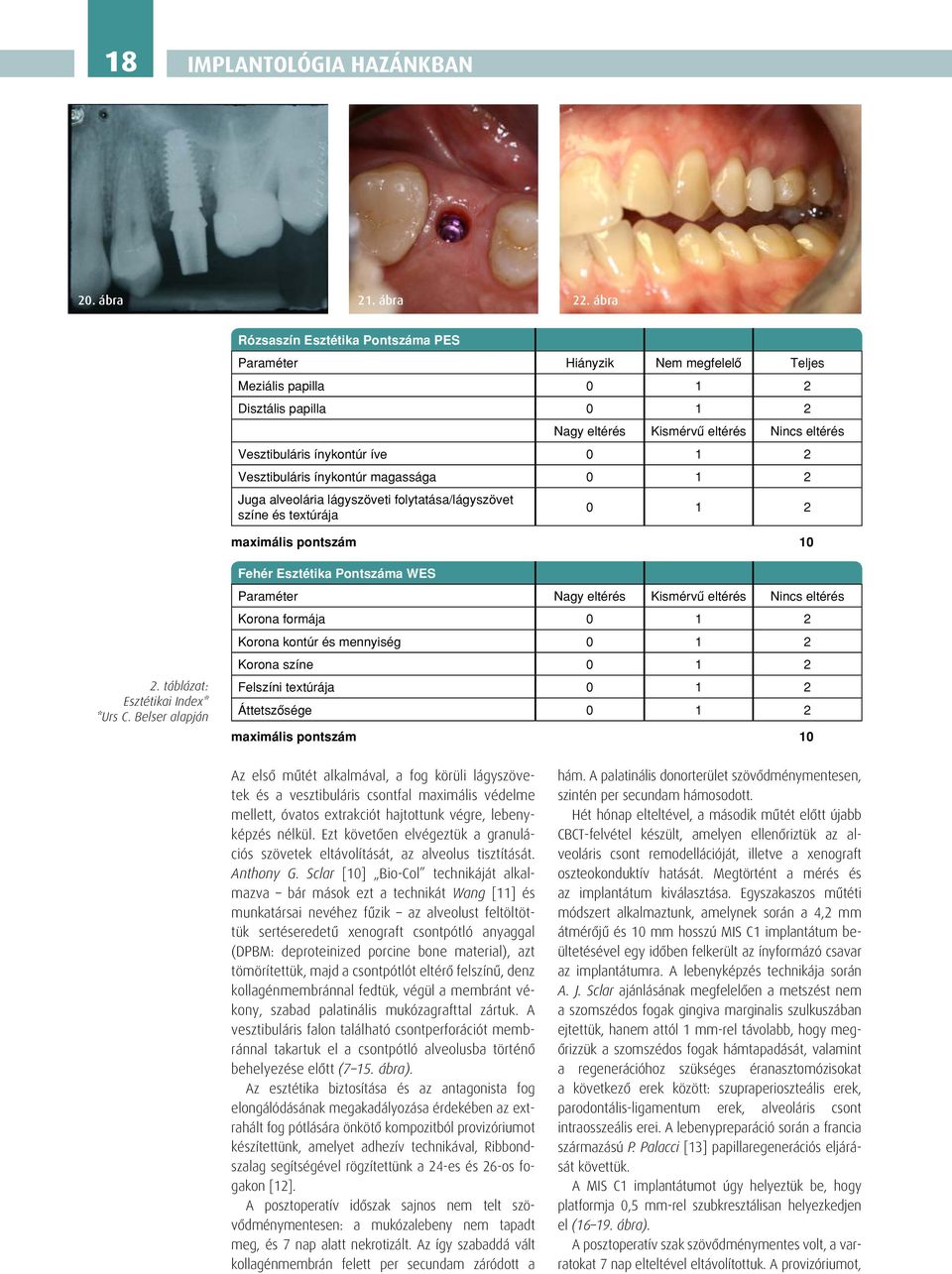 1 2 Vesztibuláris ínykontúr magassága 0 1 2 Juga alveolária lágyszöveti folytatása/lágyszövet színe és textúrája 0 1 2 maximális pontszám 10 2. táblázat: Esztétikai Index* *Urs C.