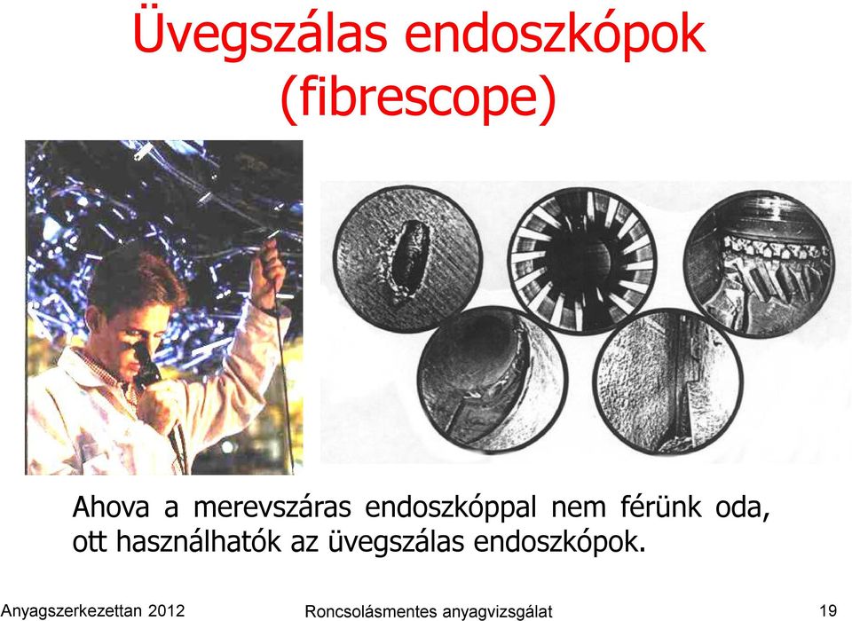 használhatók az üvegszálas endoszkópok.