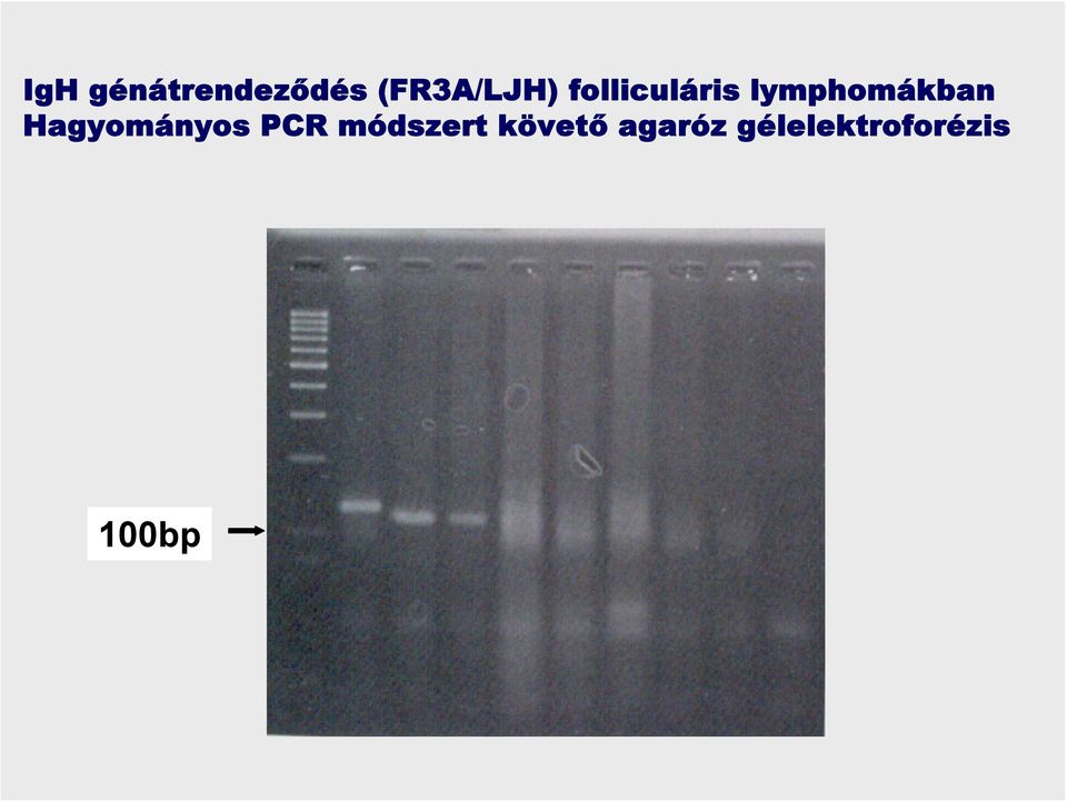 lymphomákban Hagyományos PCR
