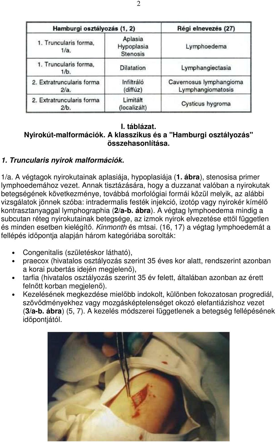 Annak tisztázására, hogy a duzzanat valóban a nyirokutak betegségének következménye, továbbá morfológiai formái közül melyik, az alábbi vizsgálatok jönnek szóba: intradermalis festék injekció, izotóp