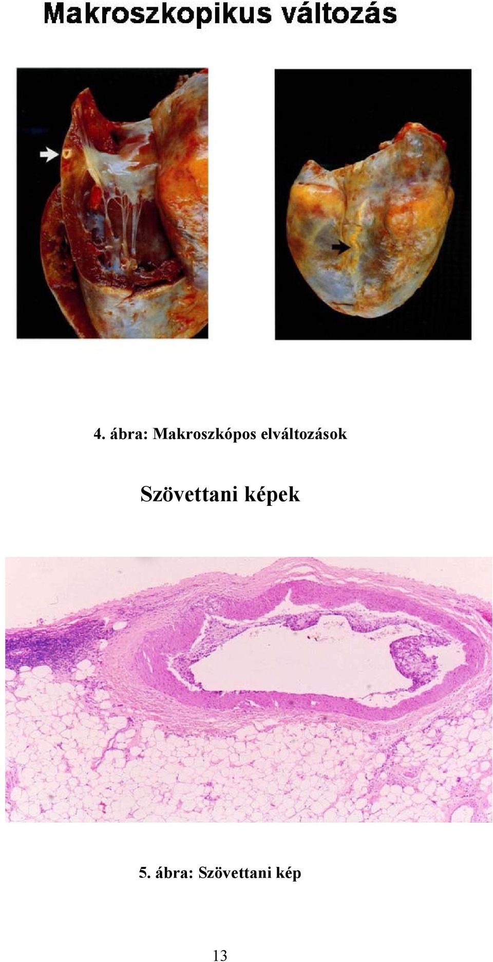 elváltozások