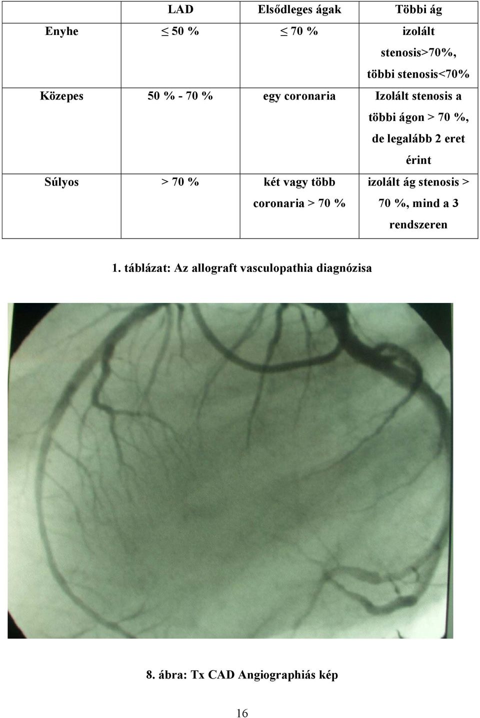 érint Súlyos > 70 % két vagy több coronaria > 70 % izolált ág stenosis > 70 %, mind a 3