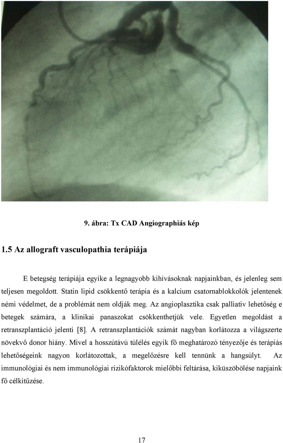 Az angioplasztika csak palliativ lehetőség e betegek számára, a klinikai panaszokat csökkenthetjük vele. Egyetlen megoldást a retranszplantáció jelenti [8].