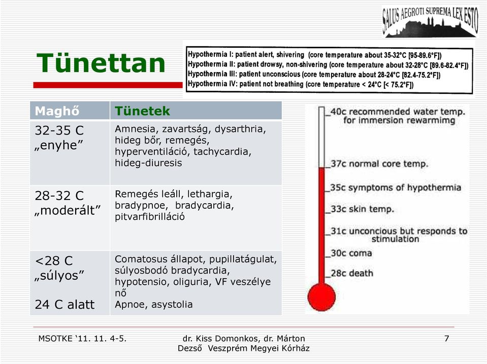 bradypnoe, bradycardia, pitvarfibrilláció <28 C súlyos 24 C alatt Comatosusállapot,