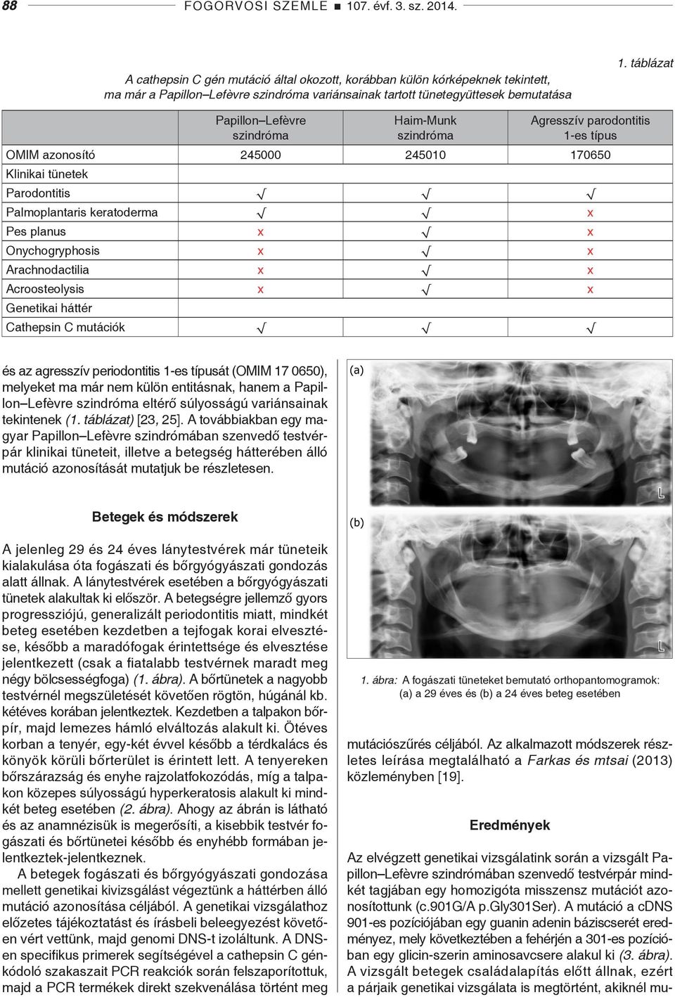 táblázat Papillon Lefèvre szindróma Haim-Munk szindróma Agresszív parodontitis 1-es típus OMIM azonosító 245000 245010 170650 Klinikai tünetek Parodontitis Palmoplantaris keratoderma x Pes planus x x