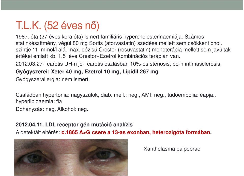 27-i carotis UH-n jo-i carotis oszlásban 10%-os stenosis, bo-n intimasclerosis. Gyógyszerei: Xeter 40 mg, Ezetrol 10 mg, Lipidil 267 mg Gyógyszerallergia: nem ismert.