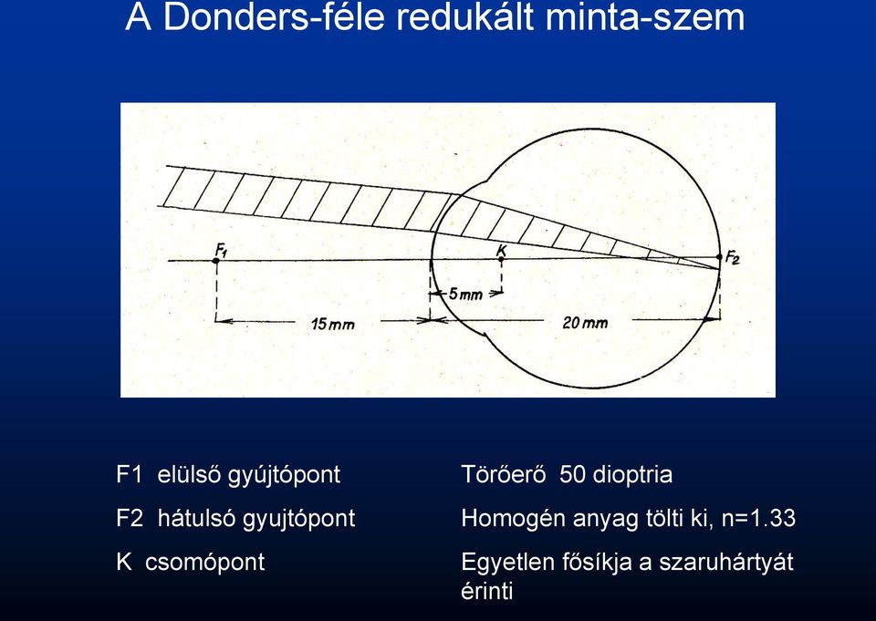 Törőerő 50 dioptria Homogén anyag tölti ki,