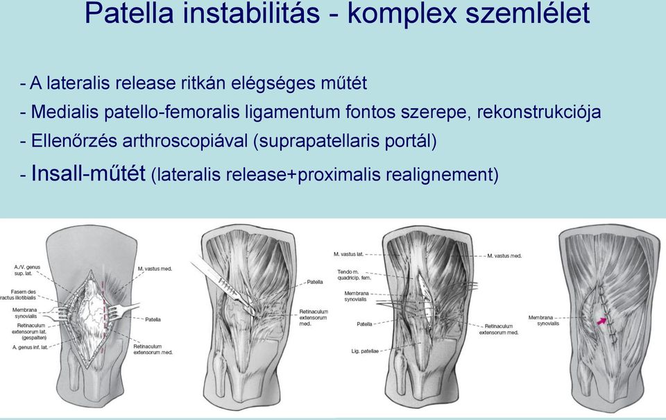 fontos szerepe, rekonstrukciója - Ellenőrzés arthroscopiával