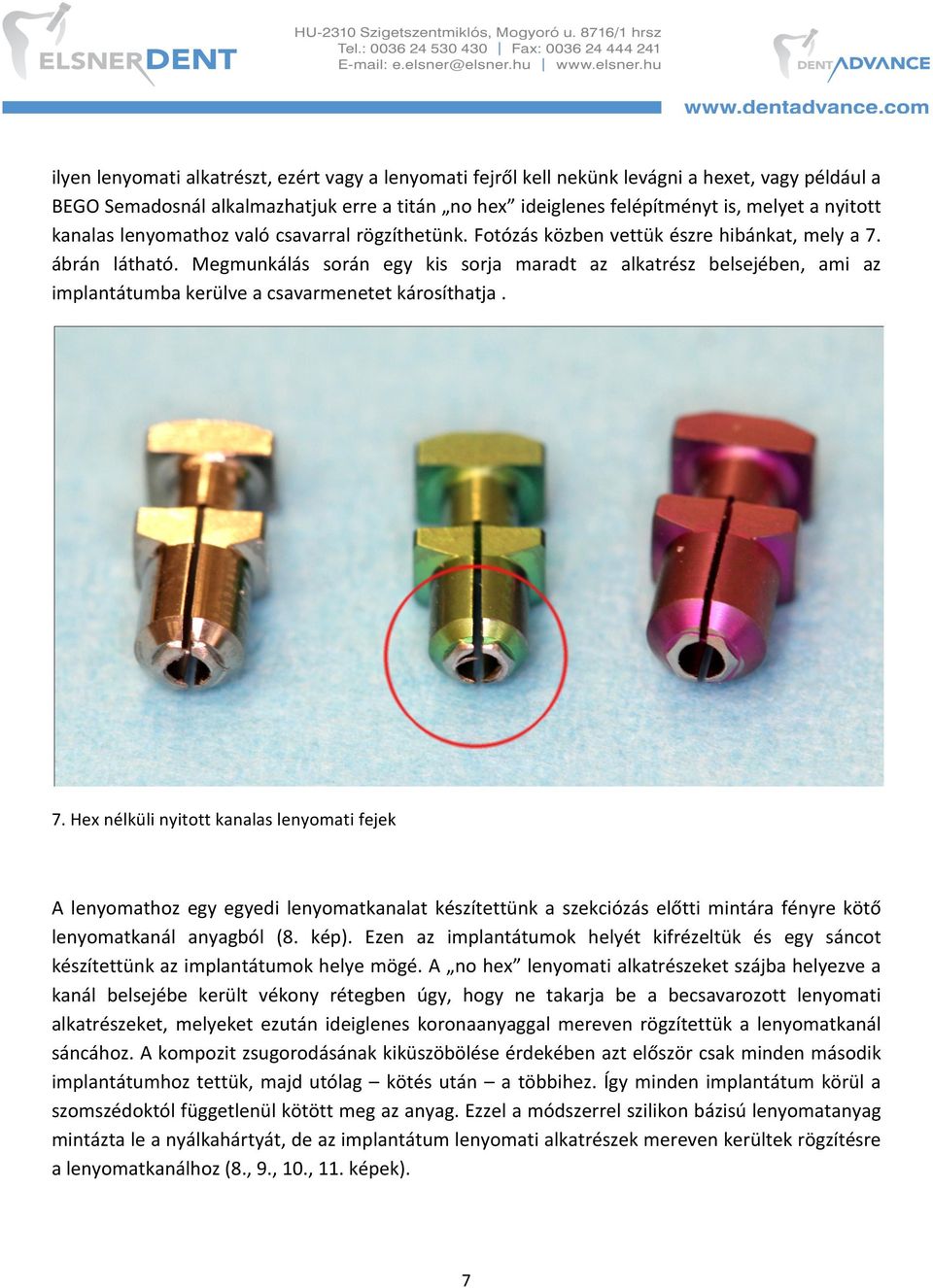 Megmunkálás során egy kis sorja maradt az alkatrész belsejében, ami az implantátumba kerülve a csavarmenetet károsíthatja. 7.