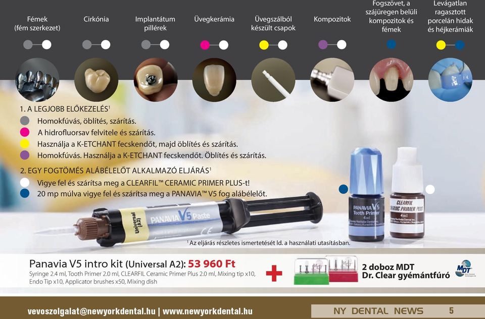 2. EGy FOGTÖMÉS ALáBÉLELŐT ALKALMAZó ELJáRáS 1 Vigye fel és szárítsa meg a CLEARFIL CERAMIC PRIMER PLUS-t! 20 mp múlva vigye fel és szárítsa meg a PANAVIA V5 fog alábélelőt.