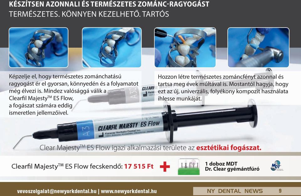 Mindez valósággá válik a Clearfil Majesty TM ES Flow, a fogászat számára eddig ismeretlen jellemzőivel. Hozzon létre természetes zománcfényt azonnal és tartsa meg évek múltával is.